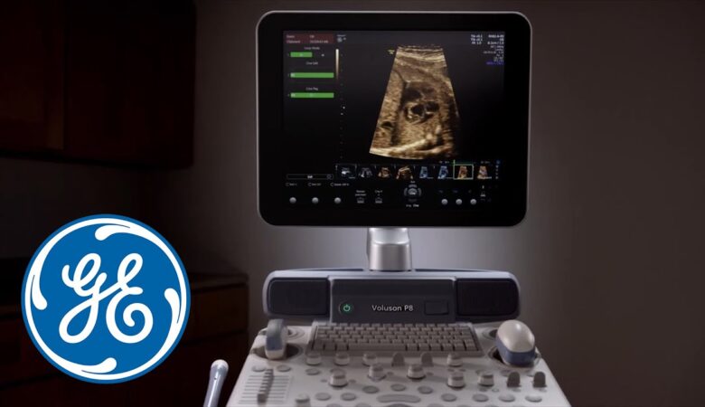 “Elevate your ultrasound capabilities with the GE Voluson p8.