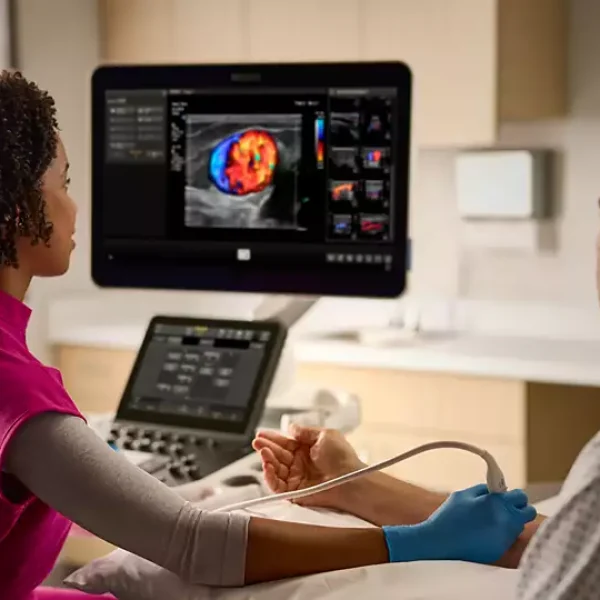 ultrasound software for Philips